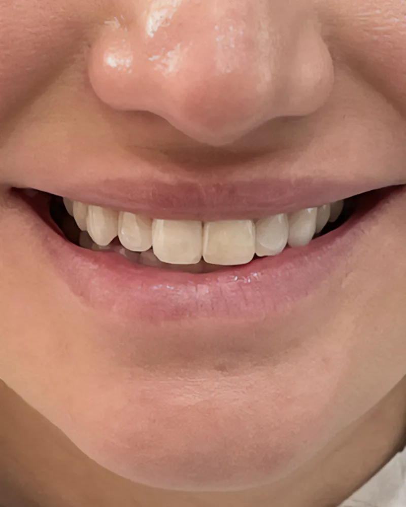 Before