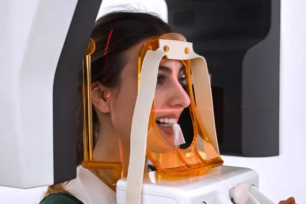 Digital X-Ray